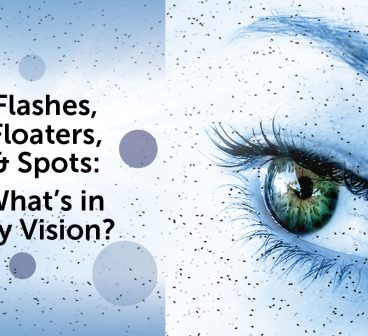 Flashes, Floaters, and Spots: What’s in my Vision?