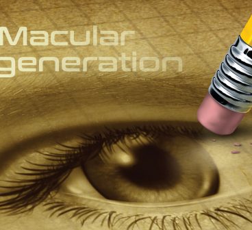 Macular Degeneration